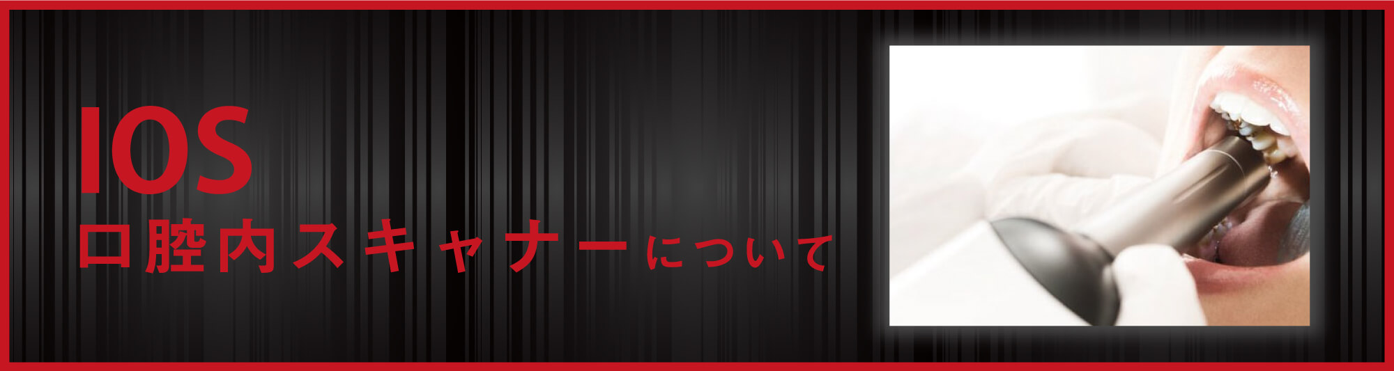 IOS口腔内スキャナー