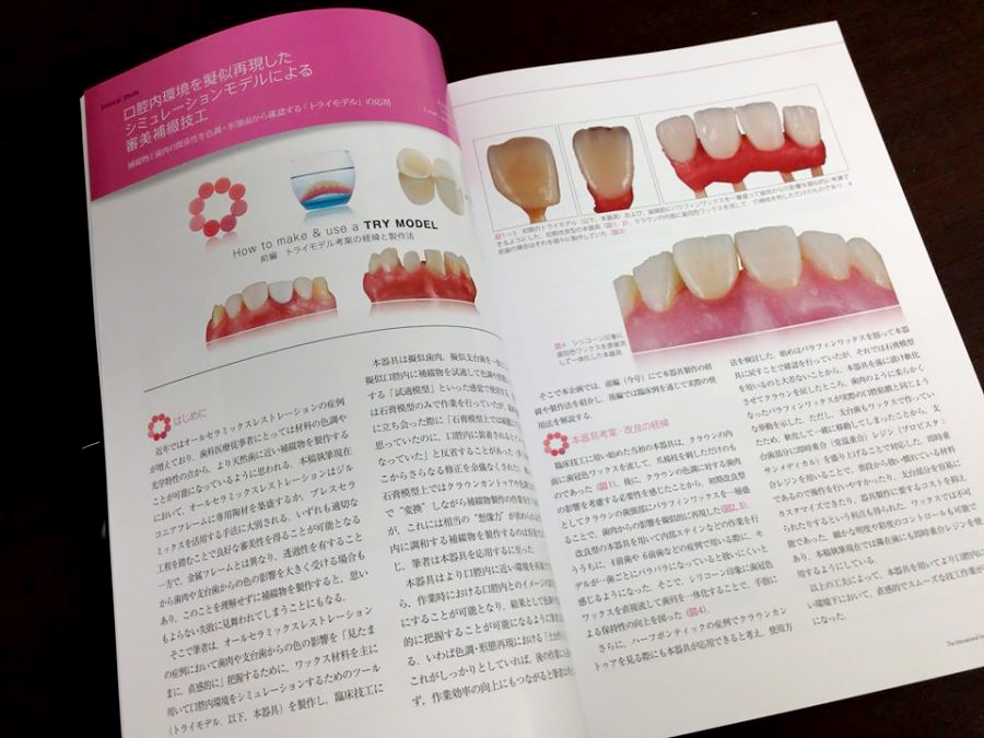 20140506_ラザロ_月刊歯科技工.jpg