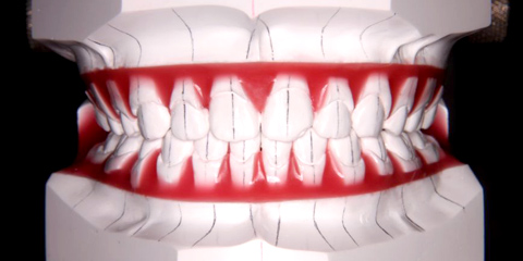 株式会社LAZARUS（ラザロ） 矯正歯科技工img01